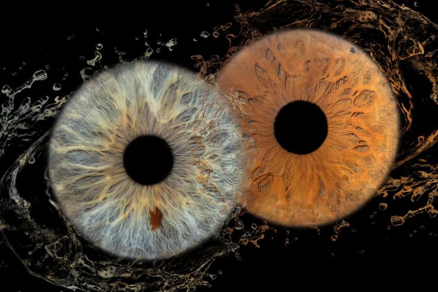 IRIS Photography (macro photo of your eye) - Key points at a glance
