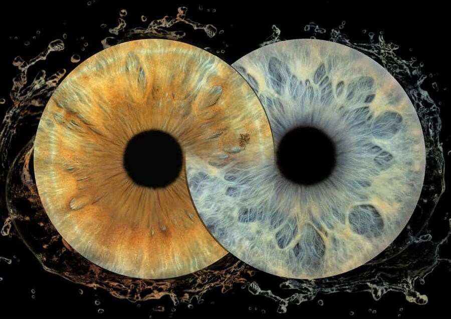 IRIS Photography (macro photo of your eye) - What your iris photo actually shows